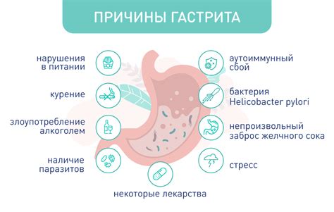 Что может произойти при нарушении срока