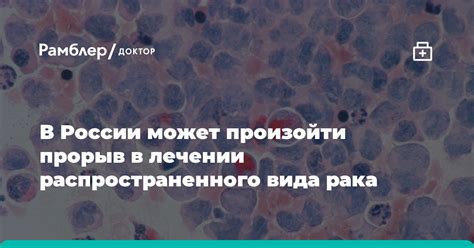 Что может произойти при некорректном лечении?