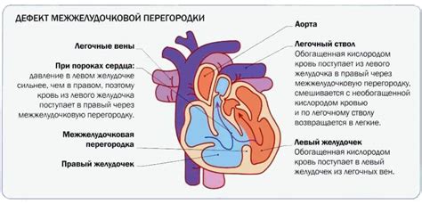 Что такое ДМЖП?