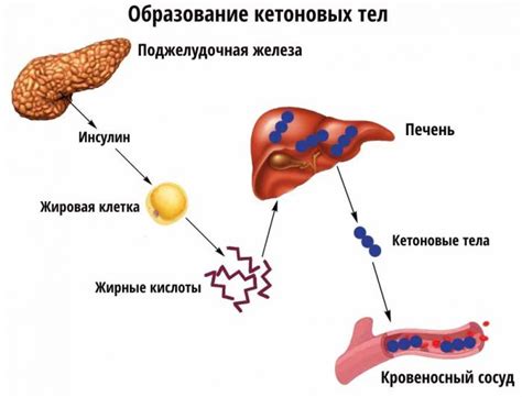 Что такое кетоновые тела и как они появляются в моче?