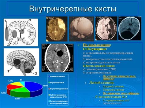 Что такое киста в голове?