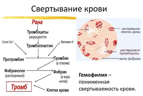 Что такое свертываемость крови?