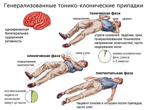 Что такое эпилепсия и почему важна пена?