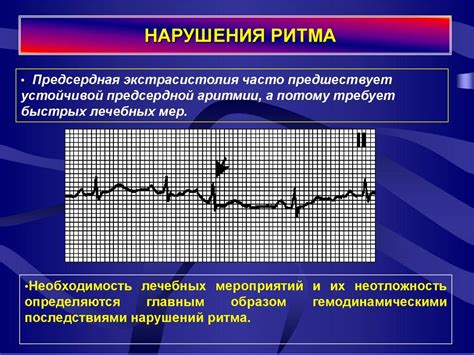 Экстрасистолия и проявление ее симптомов