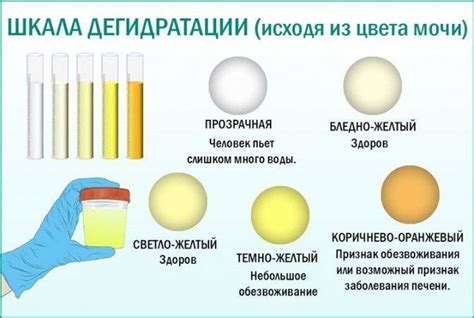 g. Другие факторы, влияющие на цвет мочи у ребенка